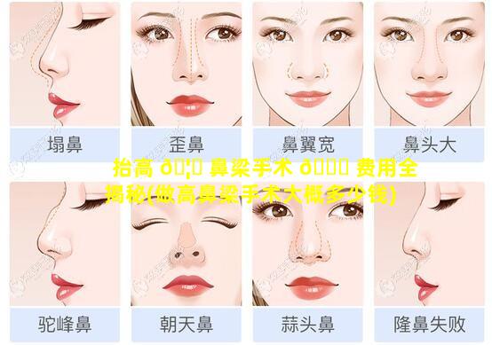 抬高 🦍 鼻梁手术 🕊 费用全揭秘(做高鼻梁手术大概多少钱)